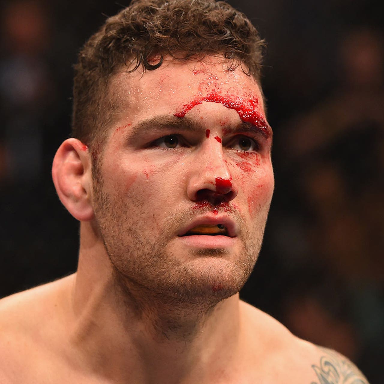 Chris Weidman details the injury that forced him out of UFC 199